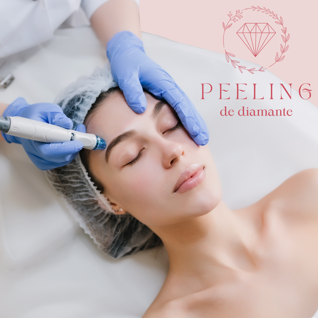 Capa do curso Peeling Diamante